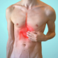acid reflux