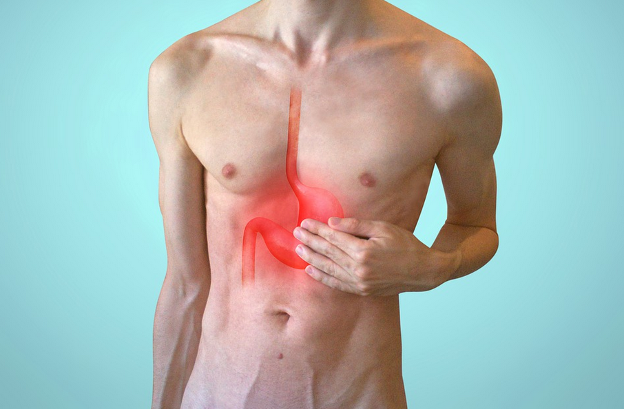 acid reflux